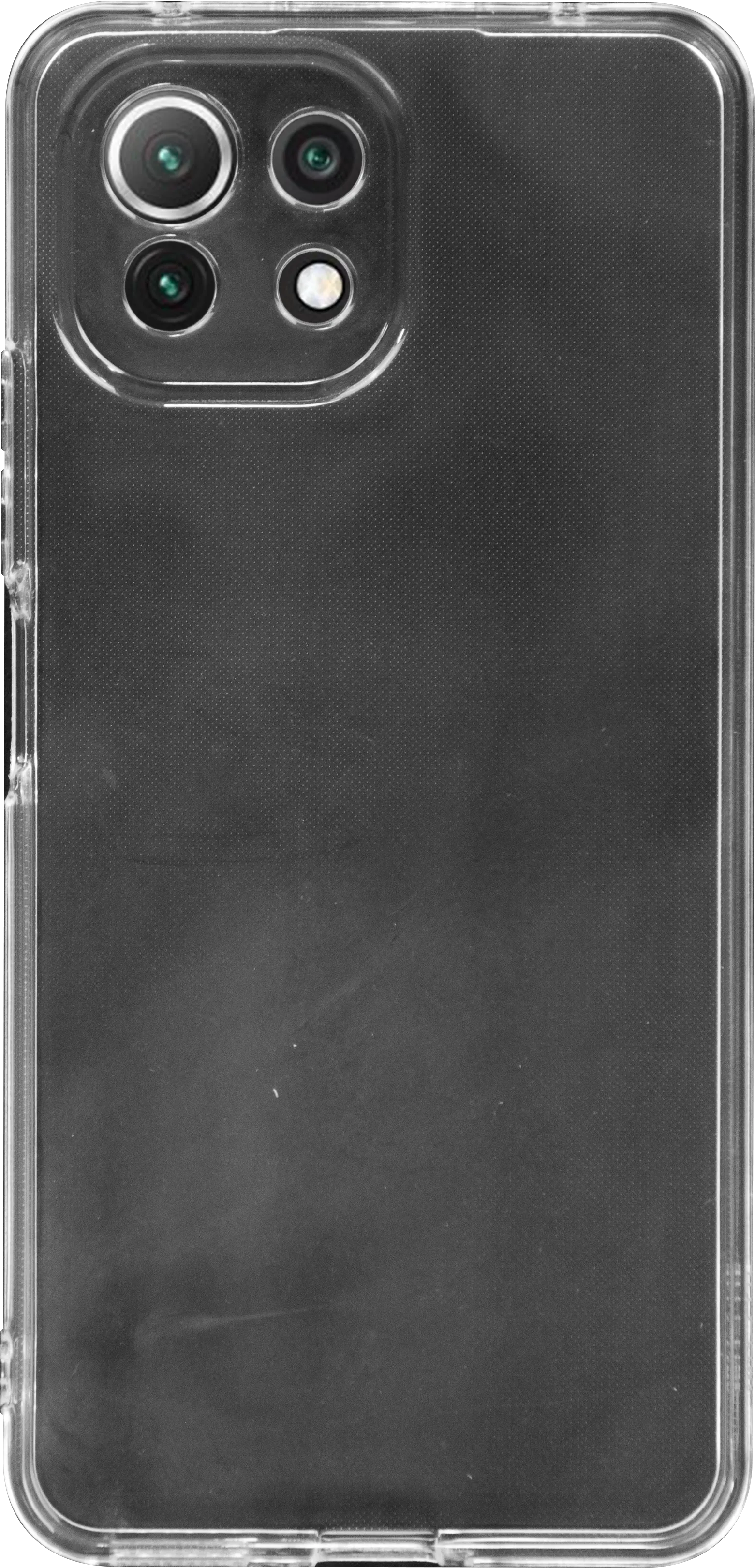 Kryt na míru | OnCase  pro Xiaomi Xiaomi MI 11 lite (2021)